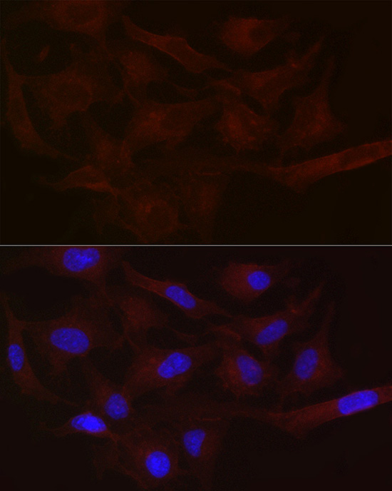 MCT1/SLC16A1 Rabbit Polyclonal Antibody - Image 2