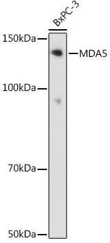 MDA5 Rabbit Monoclonal Antibody - Image 2