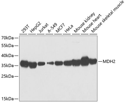 MDH2 Rabbit Polyclonal Antibody