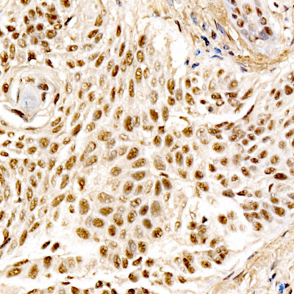 MDM2 Rabbit Monoclonal Antibody