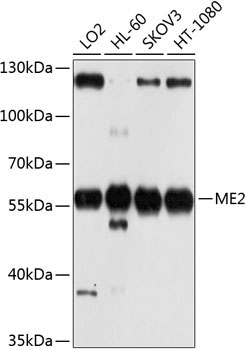 ME2 Rabbit Polyclonal Antibody