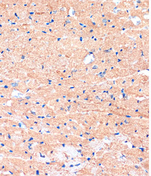 ME3 Rabbit Polyclonal Antibody - Image 2