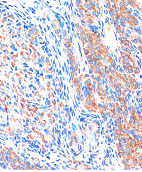 ME3 Rabbit Polyclonal Antibody - Image 3