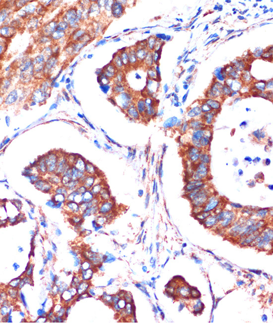 ME3 Rabbit Polyclonal Antibody - Image 4