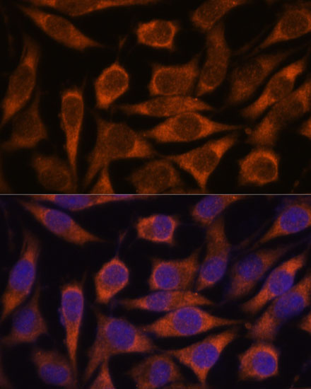 ME3 Rabbit Polyclonal Antibody - Image 5
