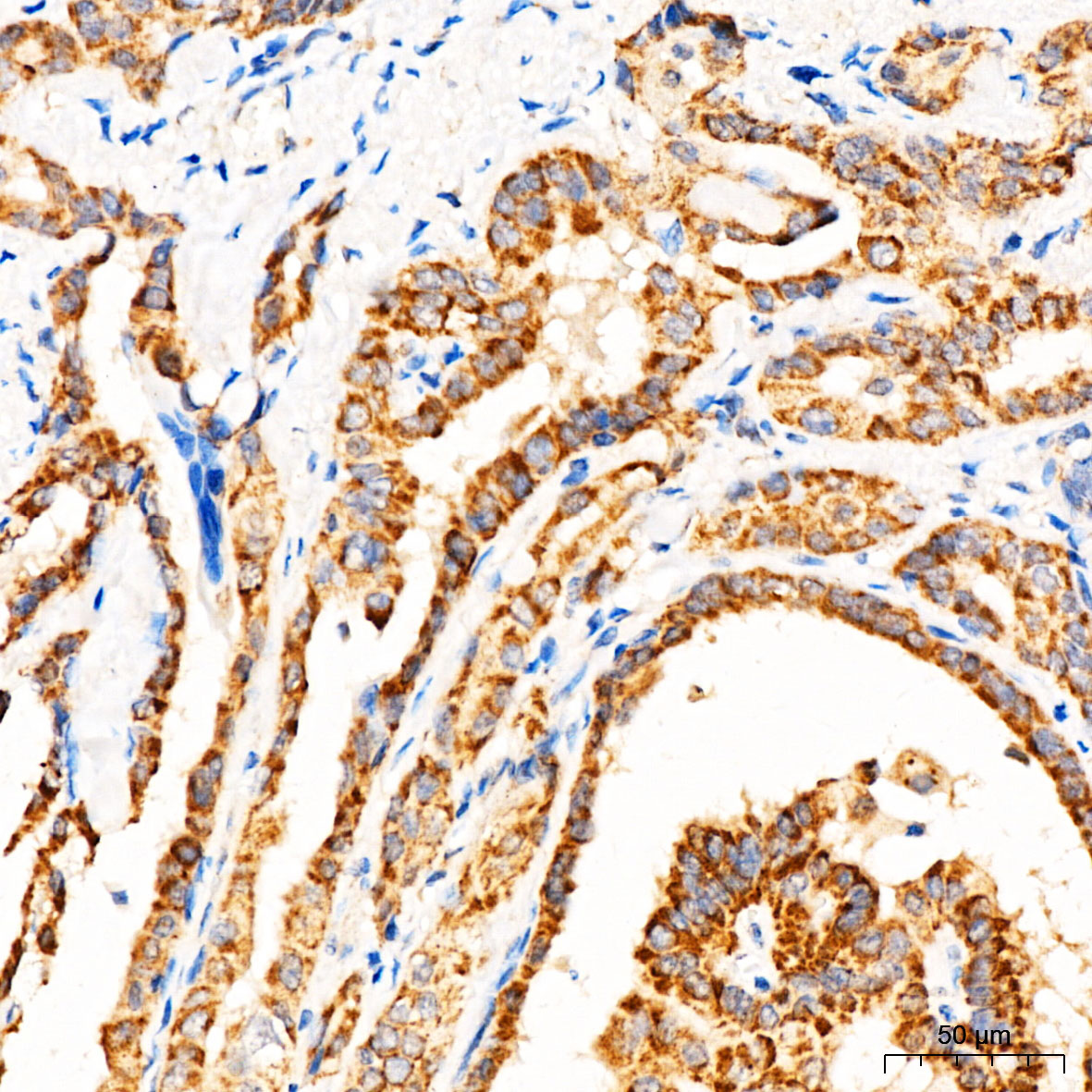 MECR Rabbit Polyclonal Antibody