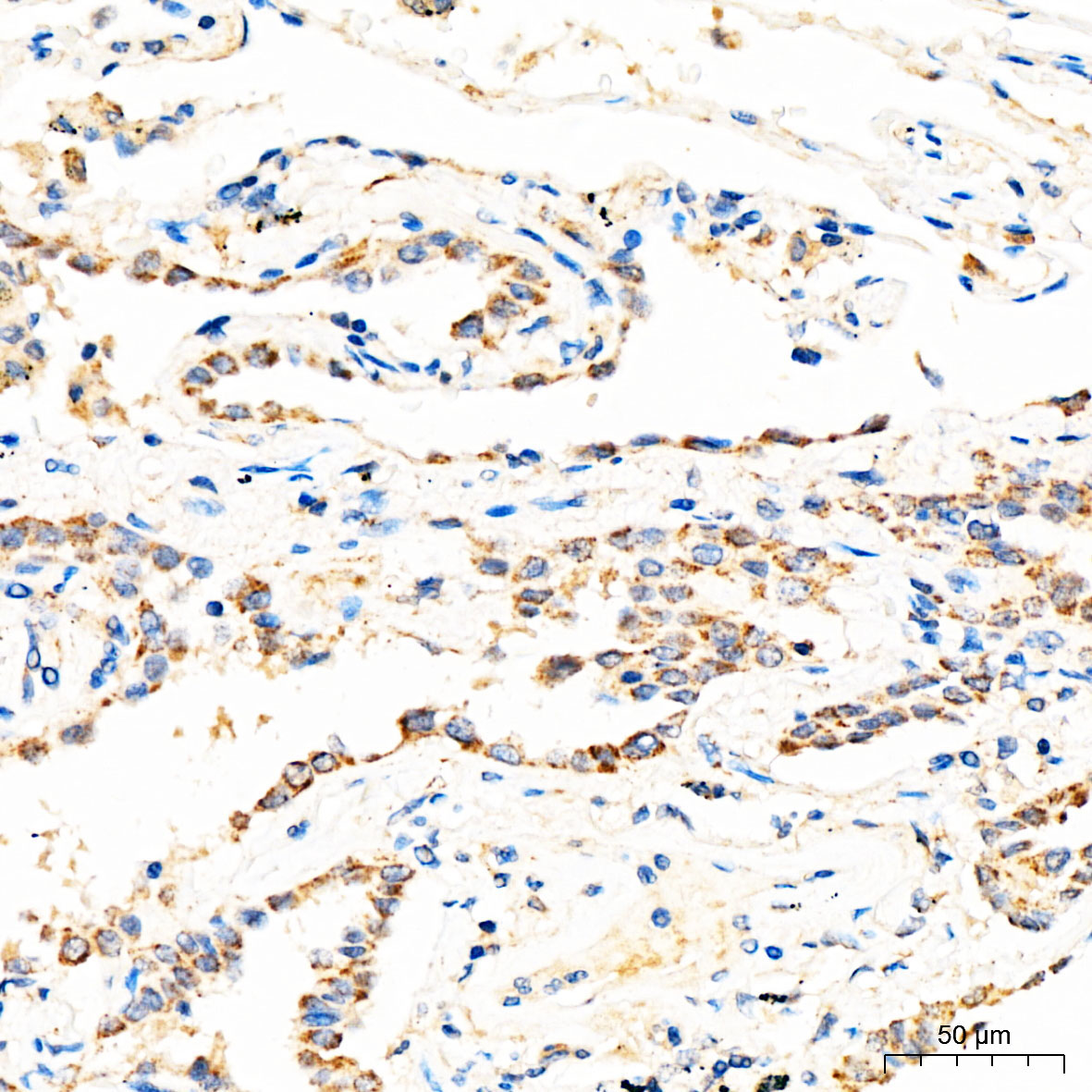 MECR Rabbit Polyclonal Antibody - Image 2
