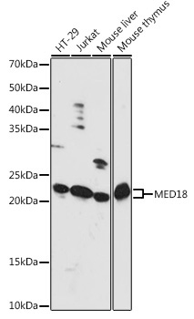 MED18 Rabbit Polyclonal Antibody