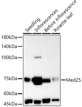 Med25 Rabbit Polyclonal Antibody