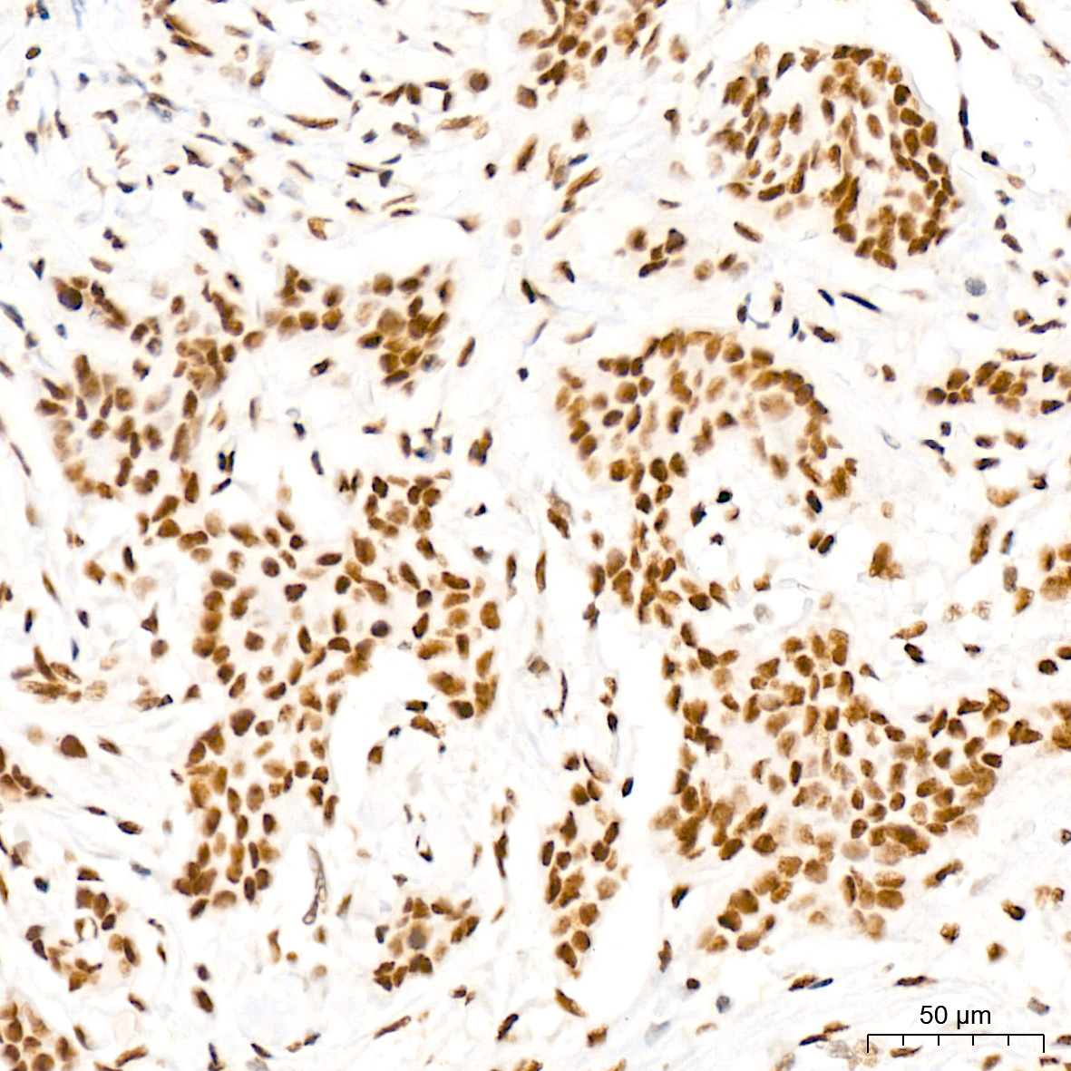 MED4 Rabbit Monoclonal Antibody - Image 2