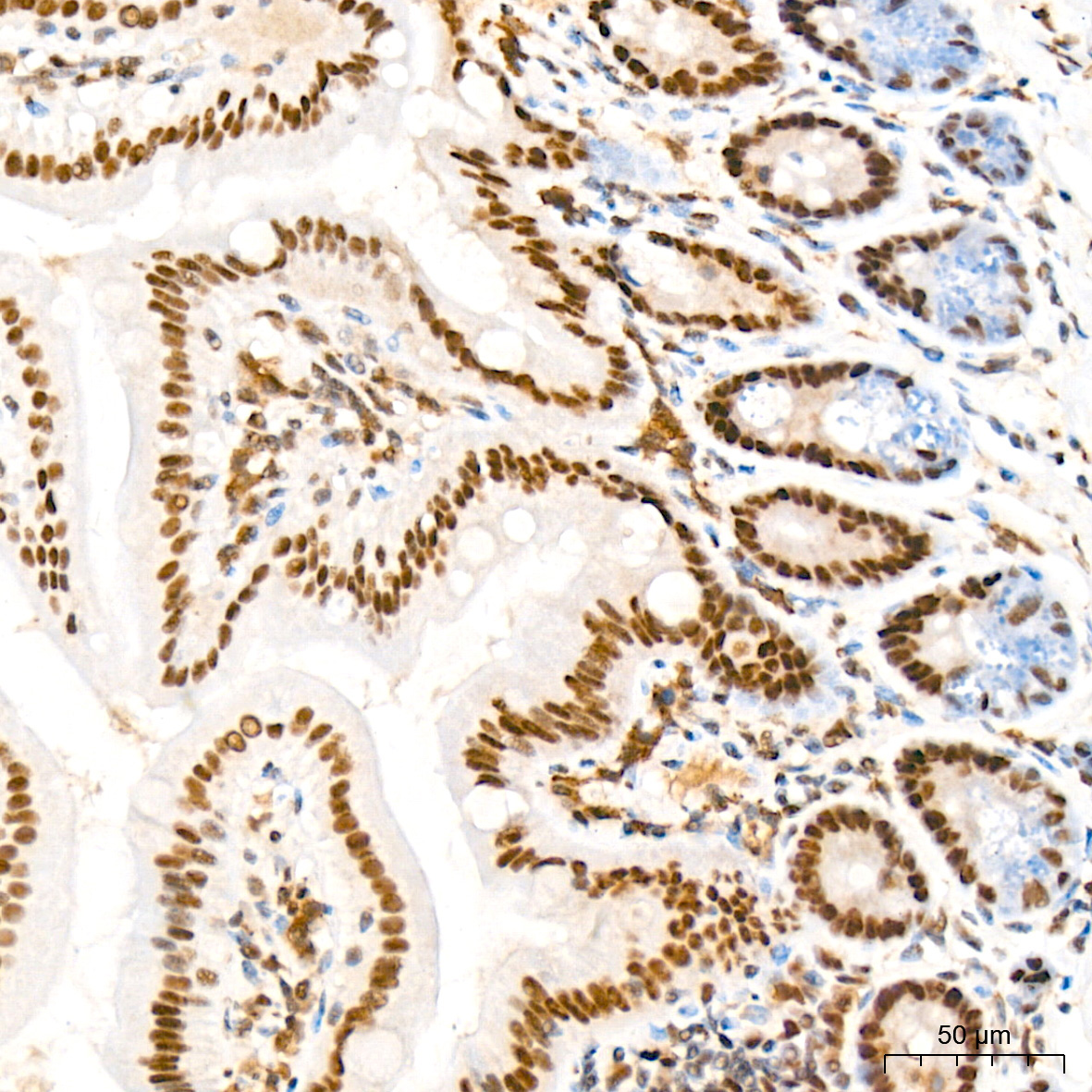 MED4 Rabbit Monoclonal Antibody - Image 4
