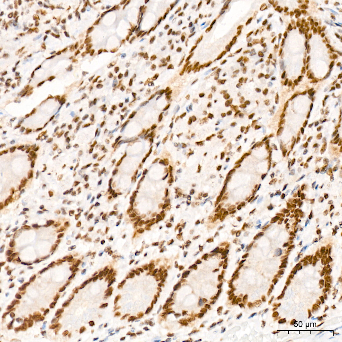 MED4 Rabbit Monoclonal Antibody - Image 6