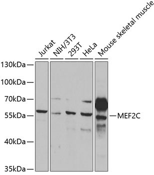 MEF2C Rabbit Polyclonal Antibody