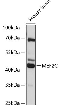 MEF2C Rabbit Polyclonal Antibody - Image 2
