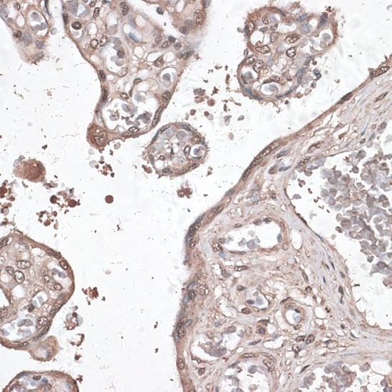 MEF2C Rabbit Polyclonal Antibody - Image 3