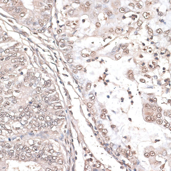 MEF2C Rabbit Polyclonal Antibody - Image 4