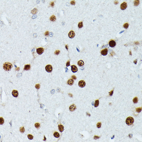 MEF2C Rabbit Polyclonal Antibody - Image 5