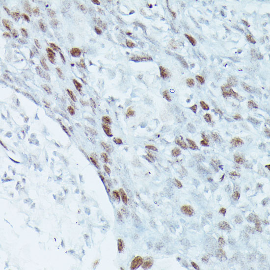 MEF2C Rabbit Polyclonal Antibody - Image 6