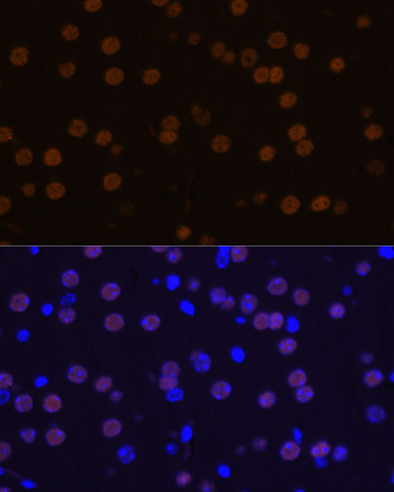 MEF2C Rabbit Polyclonal Antibody - Image 7