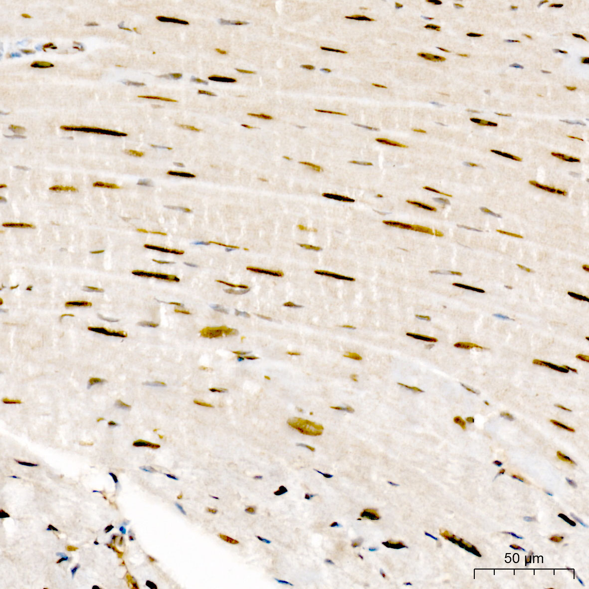 MEF2D Rabbit Polyclonal Antibody - Image 2