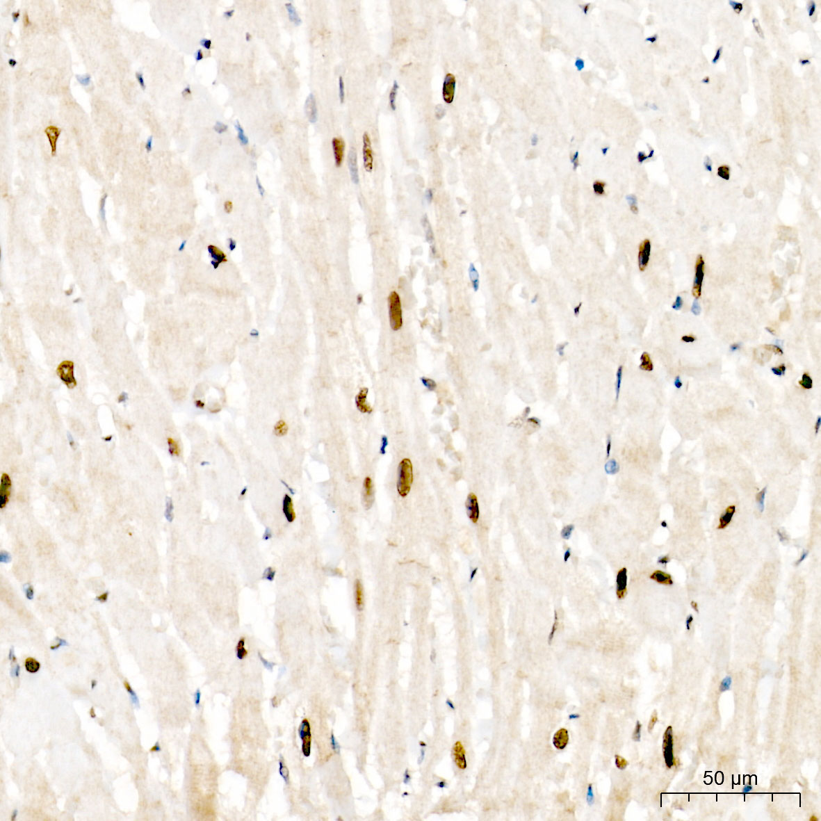MEF2D Rabbit Polyclonal Antibody - Image 3