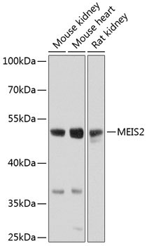 MEIS2 Rabbit Polyclonal Antibody