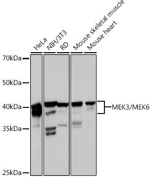 MEK3/MEK6 Rabbit Monoclonal Antibody