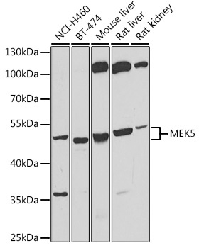 MEK5 Rabbit Polyclonal Antibody