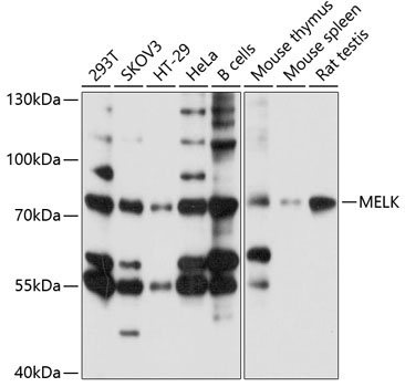 MELK Rabbit Polyclonal Antibody