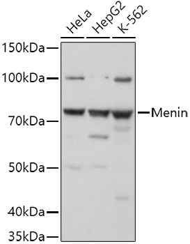 Menin Rabbit Polyclonal Antibody
