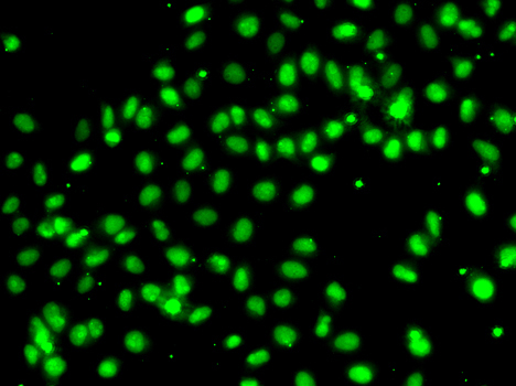 MEPCE Rabbit Polyclonal Antibody