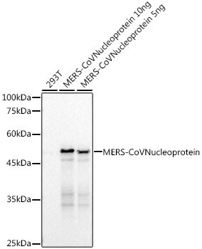 MERS-CoV Nucleoprotein Rabbit Monoclonal Antibody