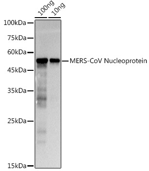 MERS-CoV Nucleoprotein Rabbit Polyclonal Antibody