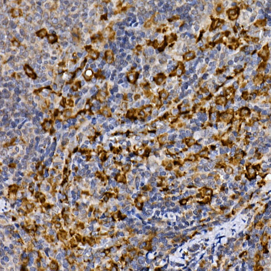MERTK Rabbit Polyclonal Antibody - Image 3