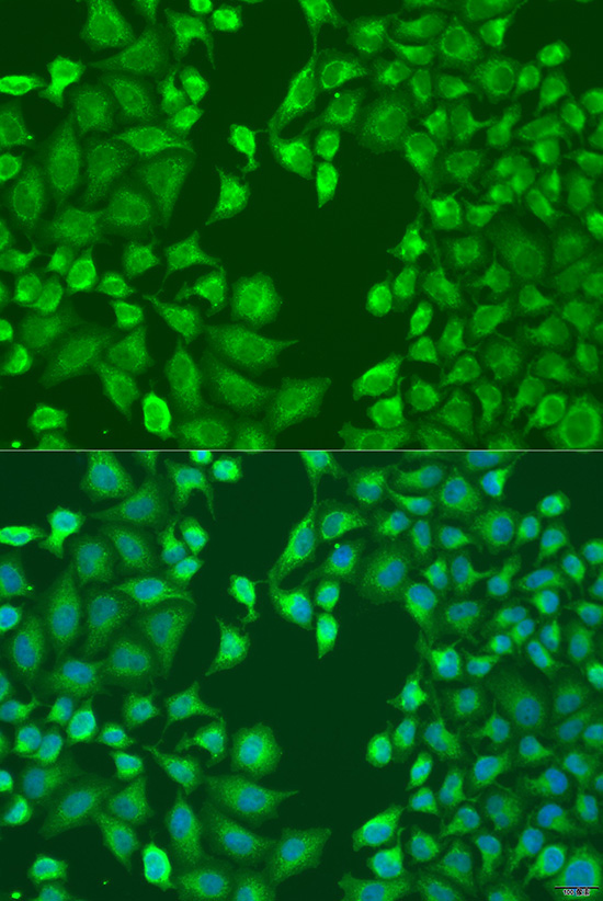 MERTK Rabbit Polyclonal Antibody - Image 4