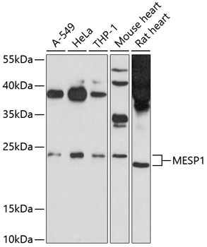 MESP1 Rabbit Polyclonal Antibody