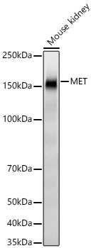 MET Rabbit Monoclonal Antibody