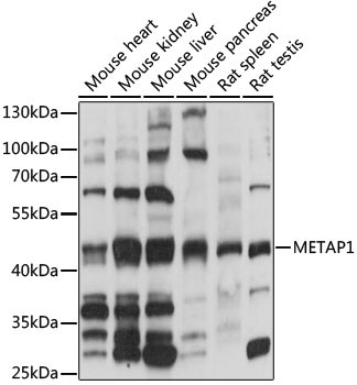 METAP1 Rabbit Polyclonal Antibody