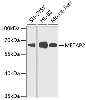 METAP2 Rabbit Polyclonal Antibody
