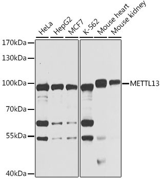 METTL13 Rabbit Polyclonal Antibody