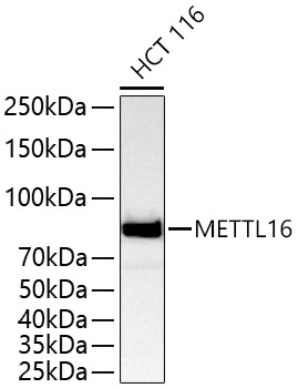 METTL16 Rabbit Polyclonal Antibody