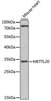 METTL20 Rabbit Polyclonal Antibody