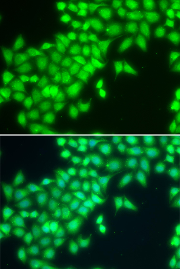 METTL2A Rabbit Polyclonal Antibody