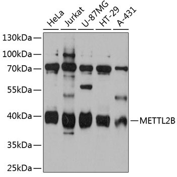 METTL2B Rabbit Polyclonal Antibody