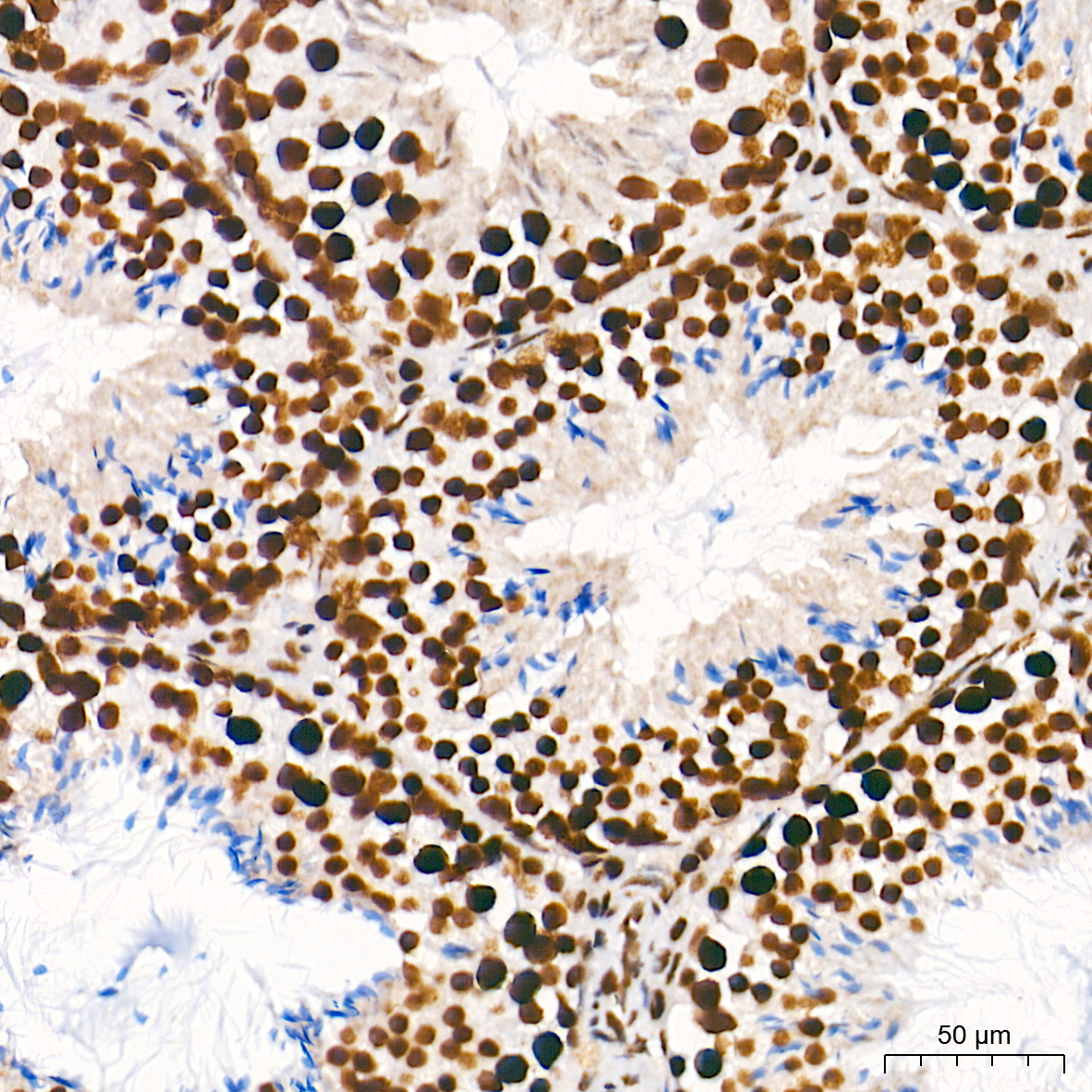 METTL3 Rabbit Monoclonal Antibody - Image 5