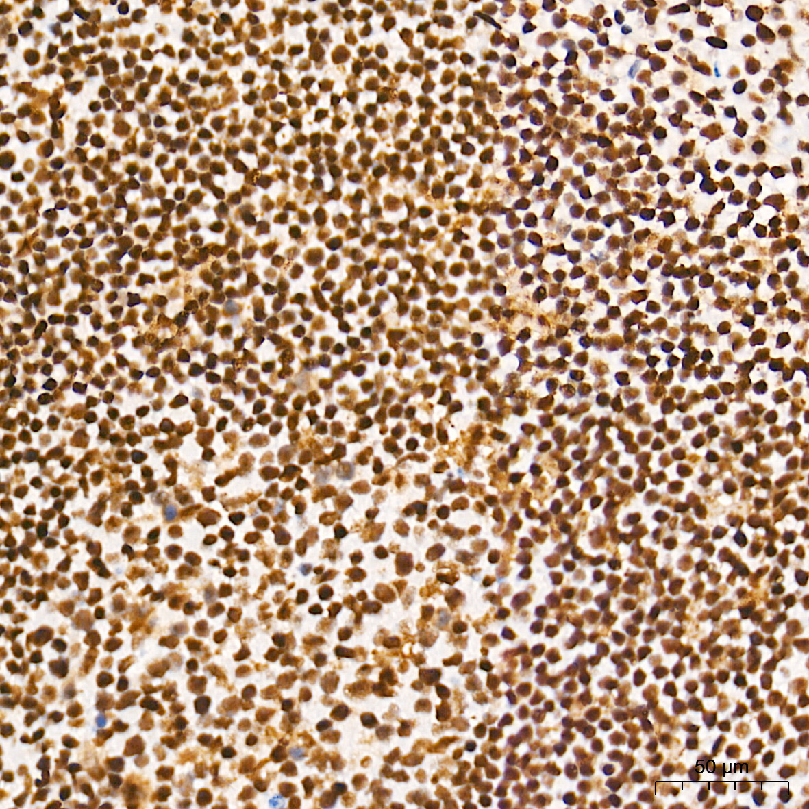 METTL3 Rabbit Monoclonal Antibody - Image 6