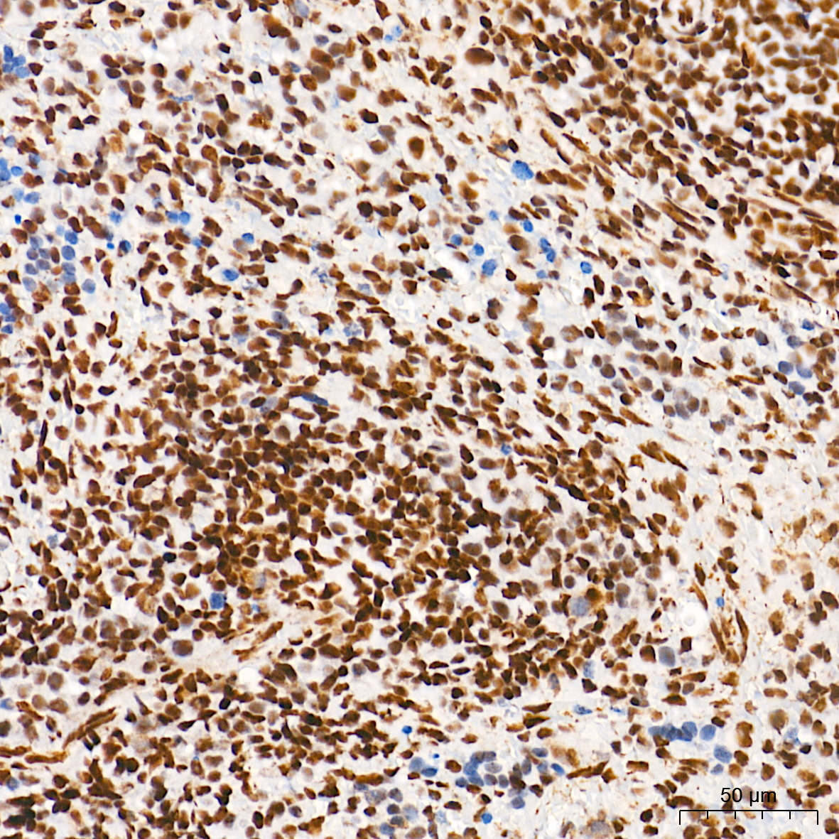 METTL3 Rabbit Monoclonal Antibody - Image 7