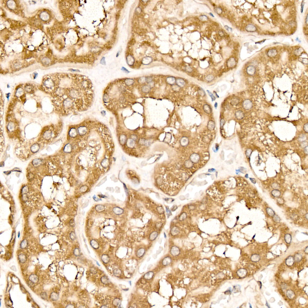 METTL4 Rabbit Monoclonal Antibody