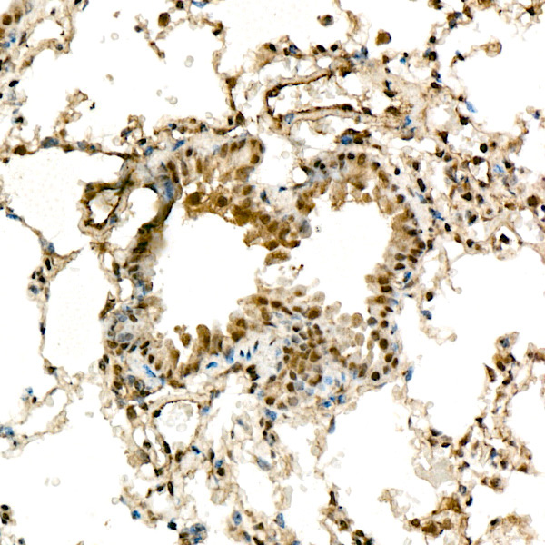 METTL4 Rabbit Monoclonal Antibody - Image 2