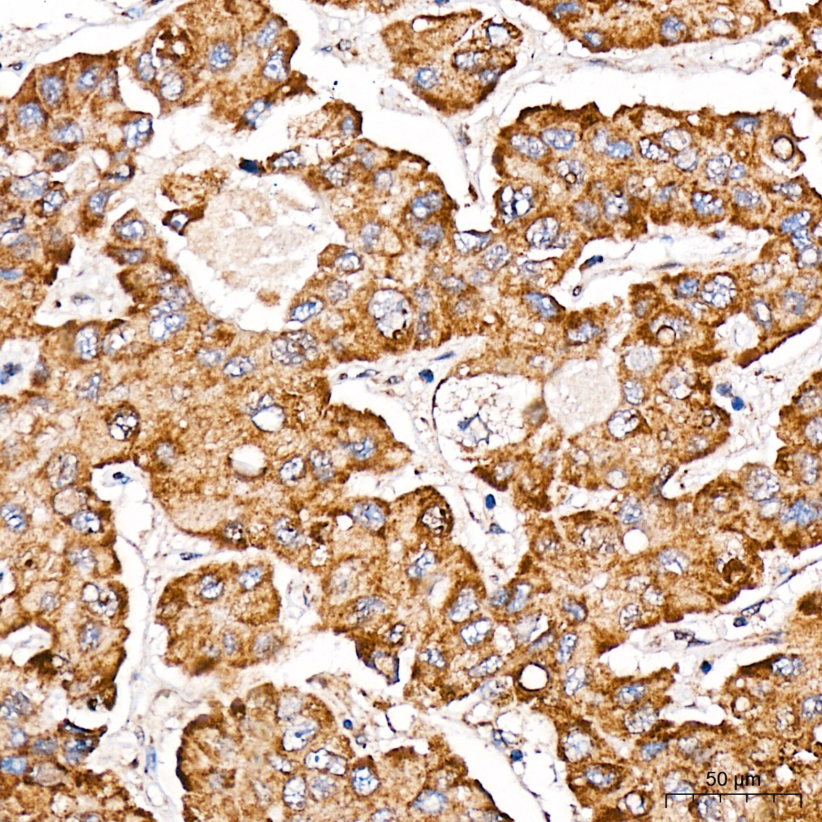 METTL4 Rabbit Polyclonal Antibody